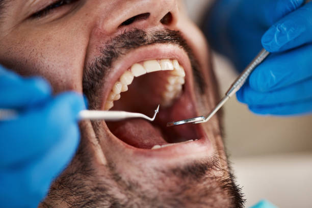 Best Emergency Treatment for Dental Infections or Abscesses in Prairie Creek, AR