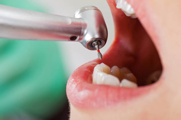 Best After-Hours Dental Trauma Care in Prairie Creek, AR